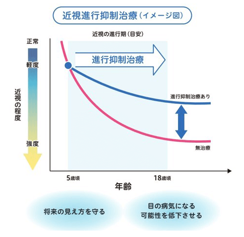 リジュセア点眼治療の効果グラフ（イメージ）