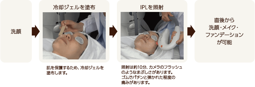施術の流れ