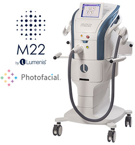 ルミナス社IPL機器　M22