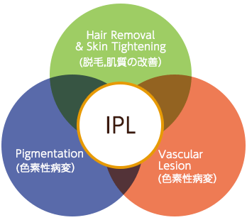 様々な肌トラブルにIPLが有効